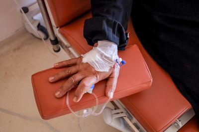 IV treatment